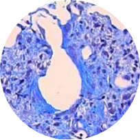 Masson trichrome staining