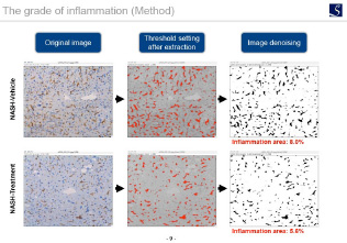The grade of inflammation (Method)