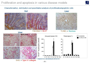 Proliferation and apoptosis in various disease models