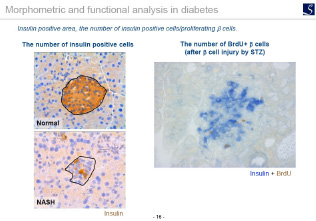 Morphometric and functional analysis in diabetes