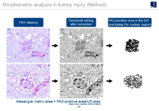 Morphometric analysis in kidney injury (Method)