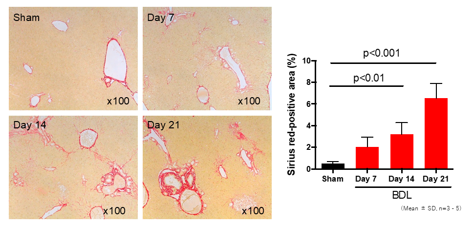 Liver fibrosis area in the BDL model