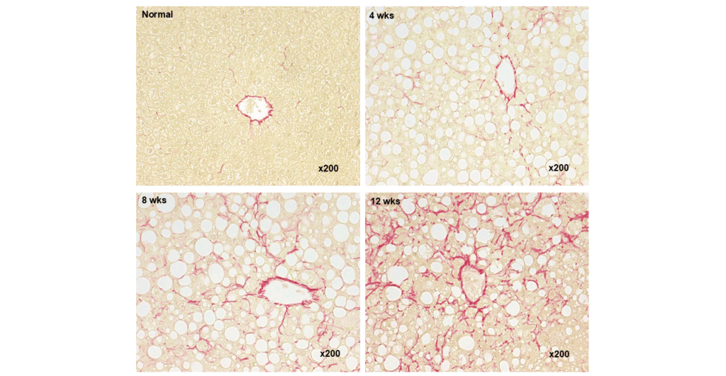 CDAHFD model - fibrosis staining