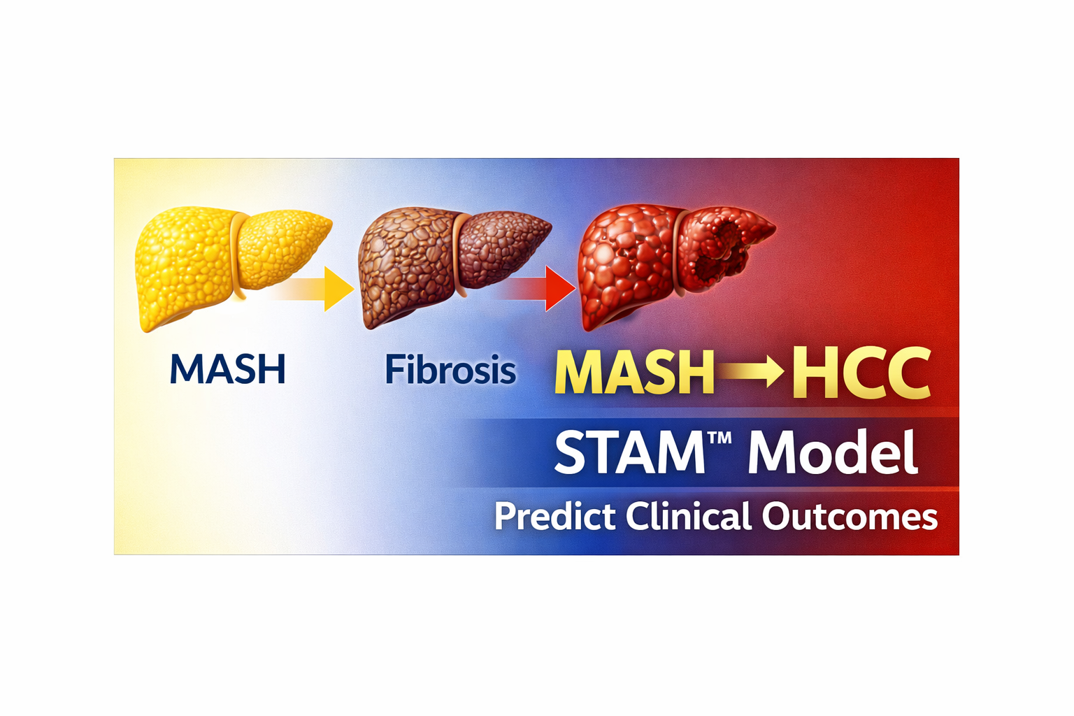 STAM™ Model for MASH to HCC | Predicting Clinical Outcomes in Preclinical Studies
