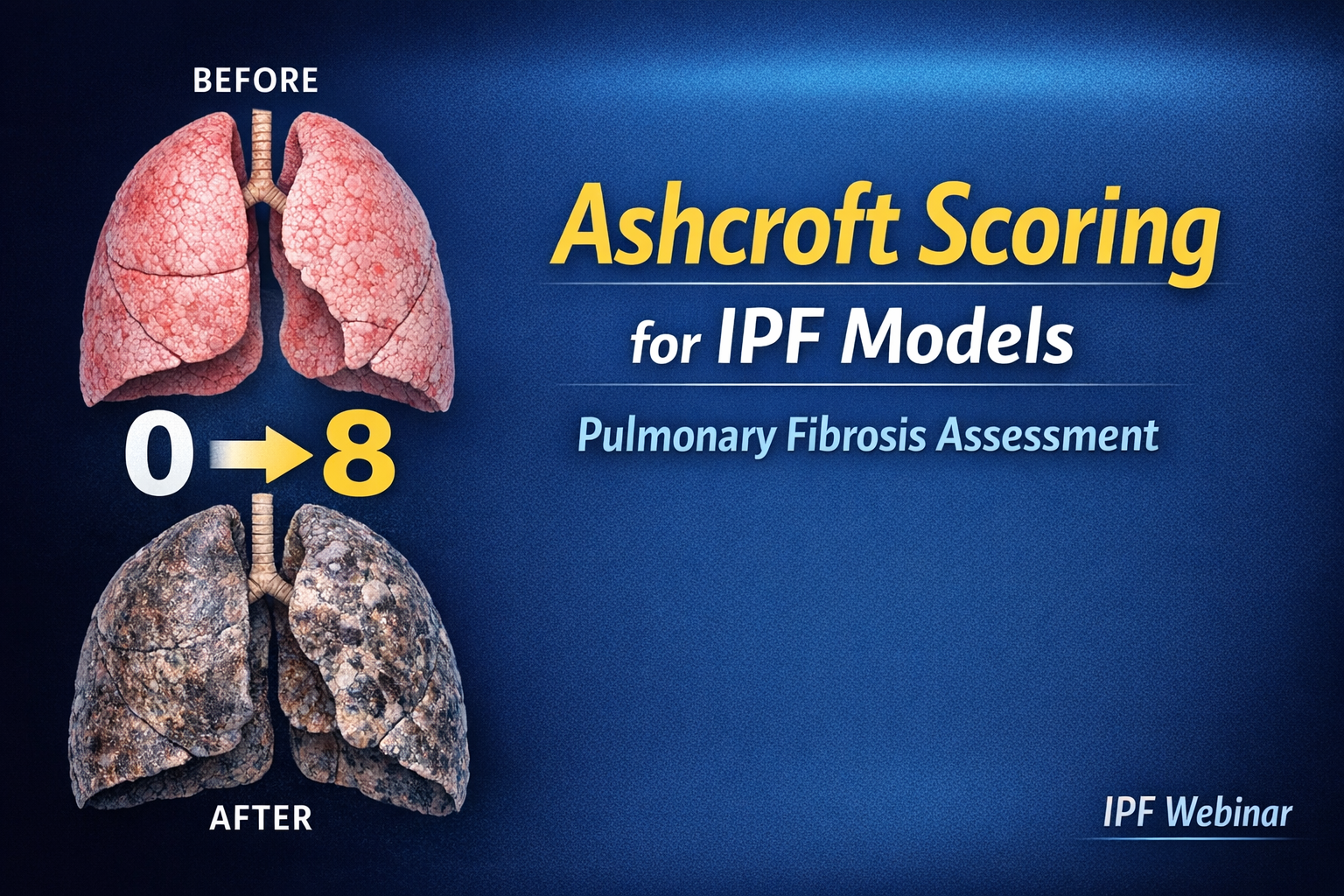 Ashcroft Scoring for Pulmonary Fibrosis Assessment | IPF Model Webinar